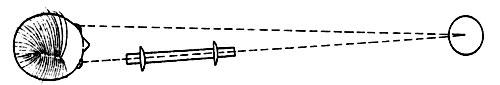 ariel view of student, lens and object